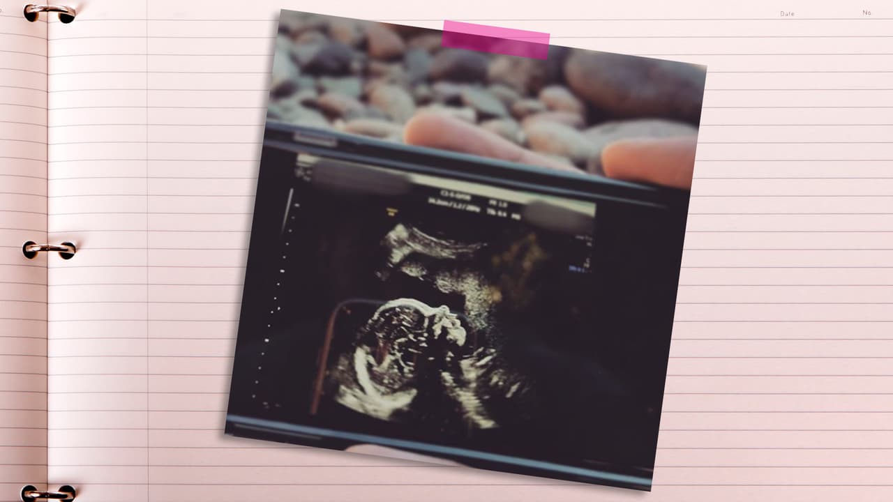 En la dulce espera de baby Melody.