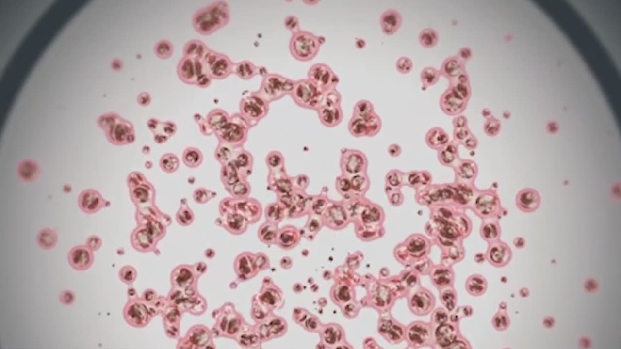 Departamento de Salud Pública de Illinois reporta posible exposición al sarampión en Union Station