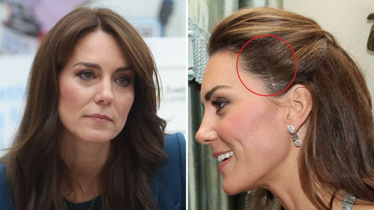 Los problemas de salud que enfrentó Kate Middleton antes del cáncer: tuvo "una operación infantil"