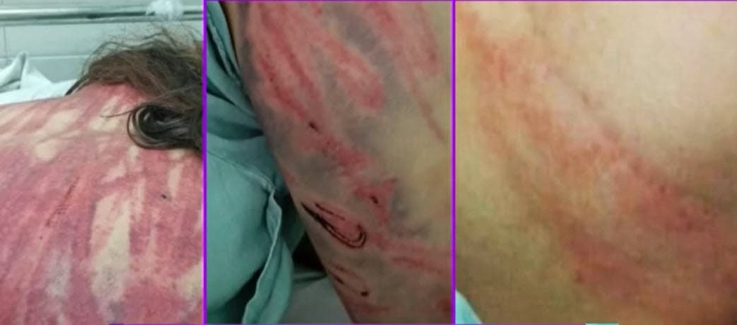 En un principio, la denuncia en su contra fue por intento de feminicidio y lesiones dolosas, pero la abogada que representaba a la pareja cambió el delito por violencia familiar y lesiones.
<br>