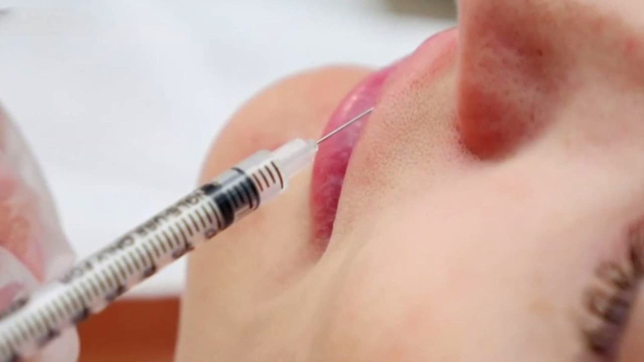 ¿Bótox para la migraña? Además de beneficios estéticos hay más