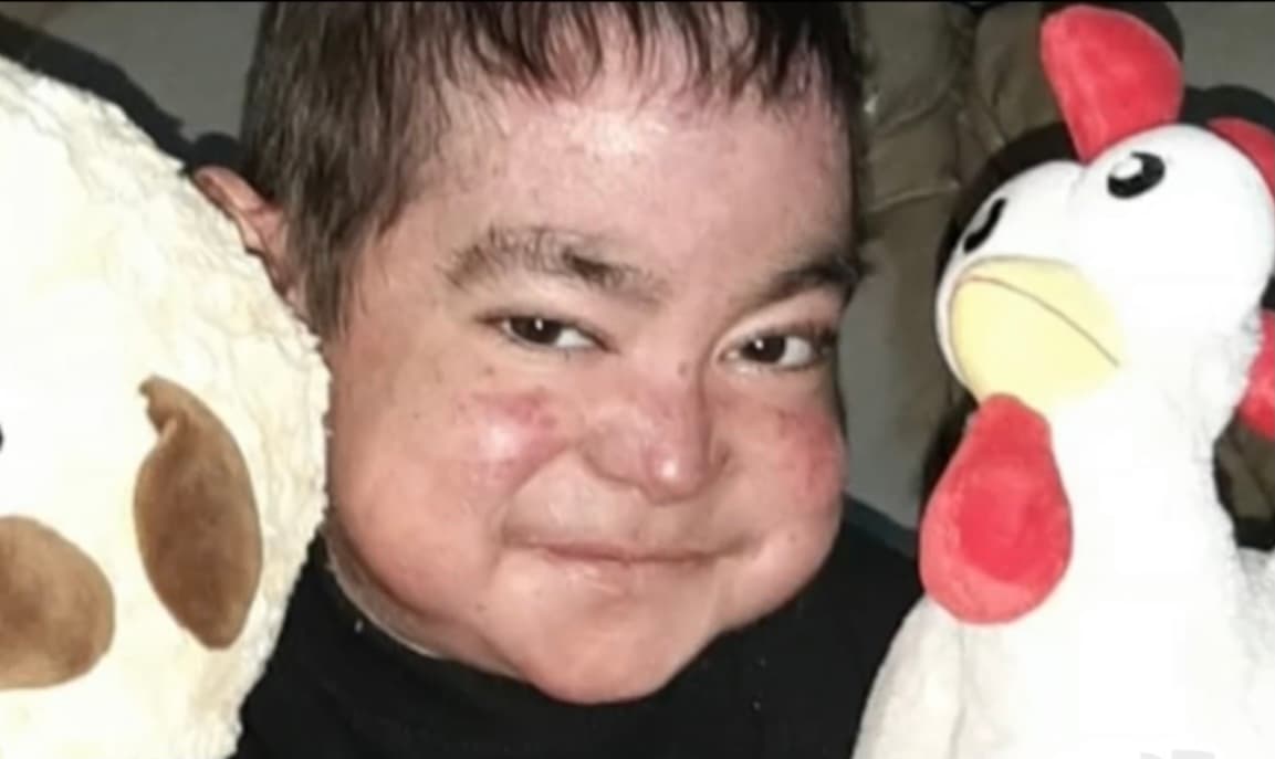 “Cada día que pasa siempre estoy triste. Rara vez me río o tengo alegría porque no camino, no escucho y me siento mal. Siempre tengo dolores en todos lados”, cuenta.
<br>
<br>
<br>