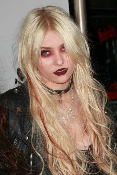 No, no tiene conjuntivitis o "pink eye"... Más videos de Chismes aquí.