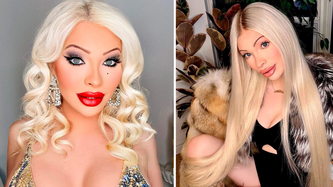 Mujer gastó 50 mil dólares en cirugías para parecerse a Marilyn Monroe: ya se arrepintió 