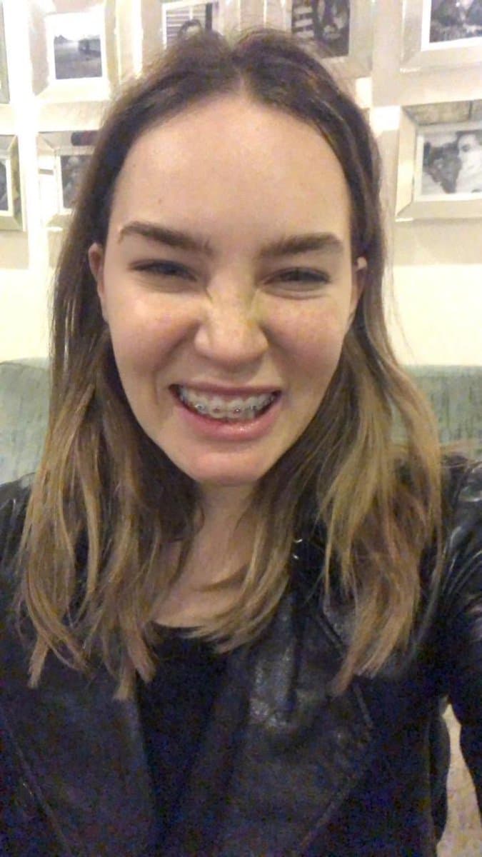 El 5 de febrero pasado, Belinda recibió fuertes críticas luego de hacer pública esta instantánea donde apareció con brackets.