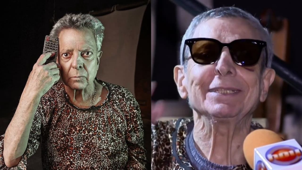 César Bono muestra cómo está su ojo tras extirpación de tumor