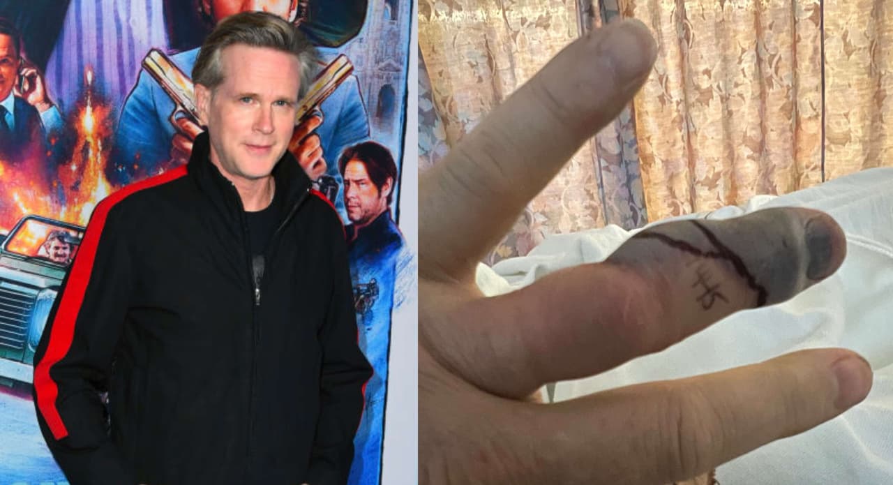 Cary Elwes, un conocido actor de Hollywood, reveló que fue atacado por una culebra cascabel.