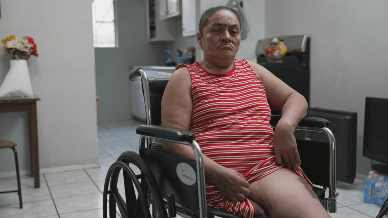 Ayuda de Impacto: La inmigrante a la que le amputaron una pierna al ser aplastada por un camión tras cruzar la frontera y ahora anhela volver con sus hijos 