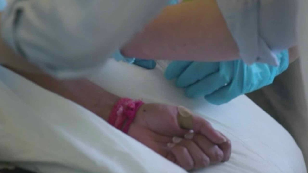 “Lo que no quiero es que la gente piense que la viruela del mono es como lo fue el ébola o algún otro virus que te mata, solo te da algo así como un sarampión o viruela”, explicó el Dr. Joseph Varón, United Memorial Medical Center.