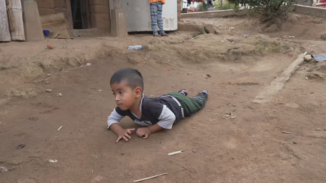 Sueña con ser policía y con correr junto a sus hermanos, pero un defecto congénito no le permite caminar