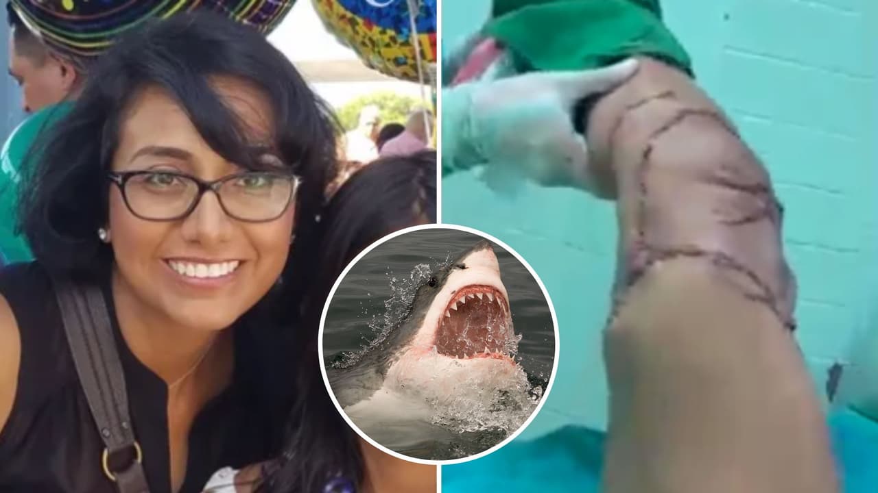 Tiburón desgarra pierna de enfermera hispana de San José que nadaba en Ecuador