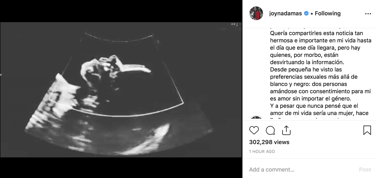 "Quería compartirles esta noticia tan hermosa e importante en mi vida hasta el día, que ese día llegara, pero hay quienes, por morbo, están desvirtuando la información.
<br>Desde pequeña he visto las preferencias sexuales más allá de blanco y negro: dos personas amándose con consentimiento para mi es amor sin importar el género".