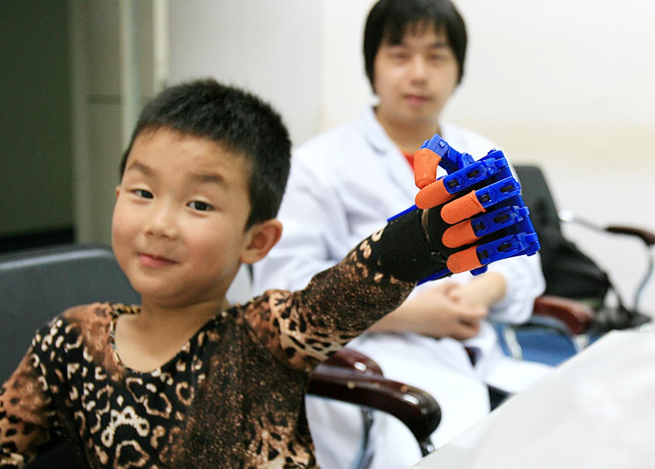 Sólo tomó siete horas imprimir la mano que permite al niño sujetar cosas ligeras, ¡y ahora es el niño más feliz!