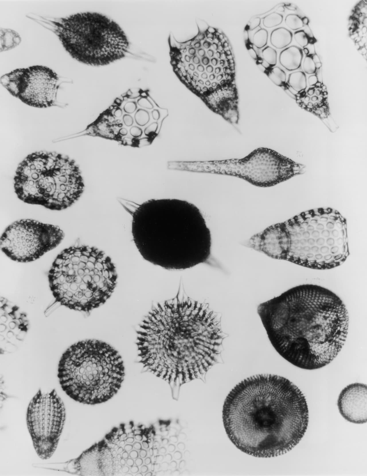 Múltiples protozoos ameboides, criaturas que microscópicas que forman parte del plancton, retratados en una placa de rayos X.