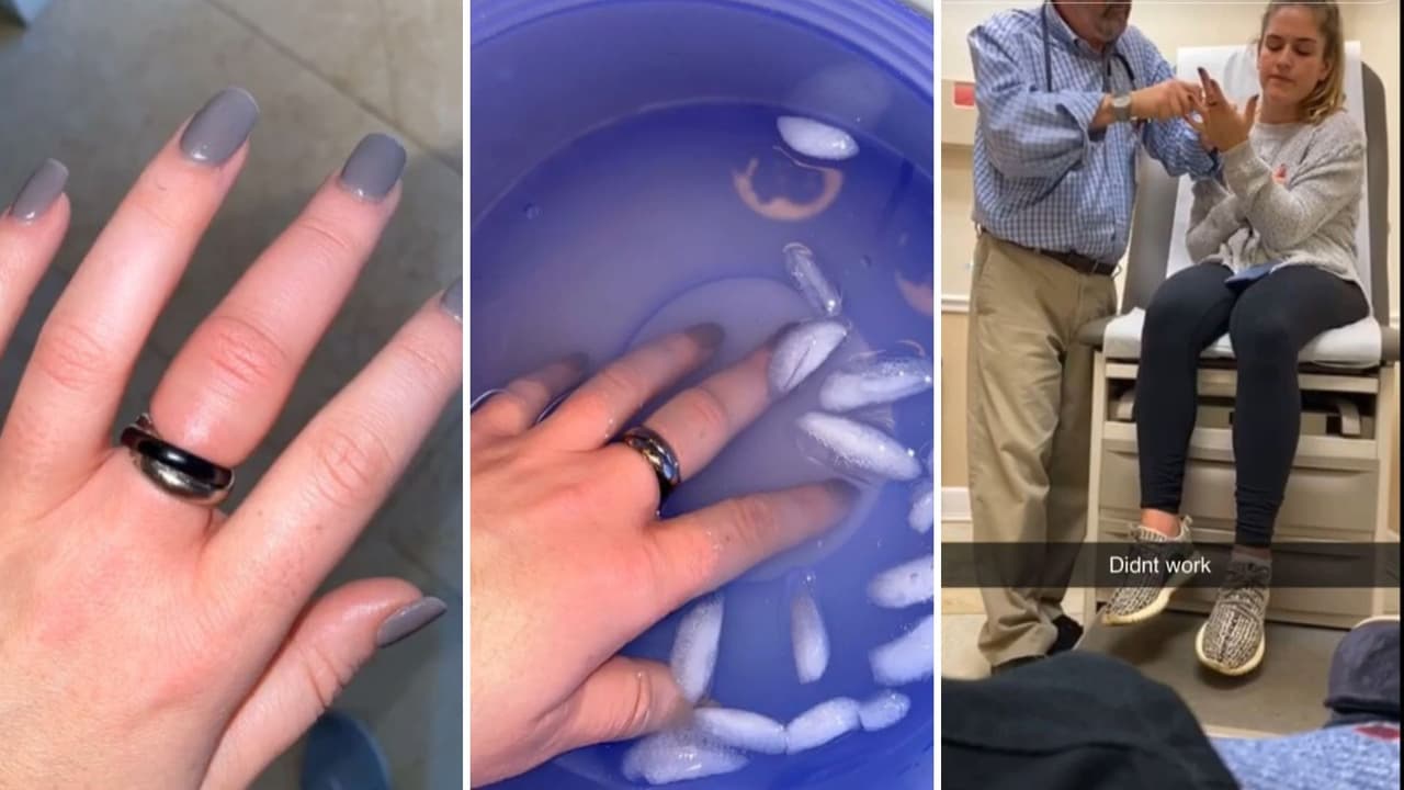 La joven probó de todo para retirarlo y no pudo hacer nada