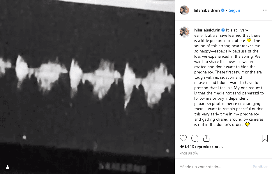 "Todavía 
<b>es muy temprano</b>... pero sabemos que hay una pequeña persona dentro de mí. El sonido de este corazón fuerte me hace muy feliz, especialmente por la pérdida que experimentamos en la primavera", escribió Hilaria el miércoles 18 de septiembre en su cuenta de 
<b><a href="https://www.instagram.com/p/B2jwlYsH_6d/" target="_blank">Instagram</a></b> junto con un video en el que se escucha el latido del corazón del nuevo integrante de la familia Baldwin.