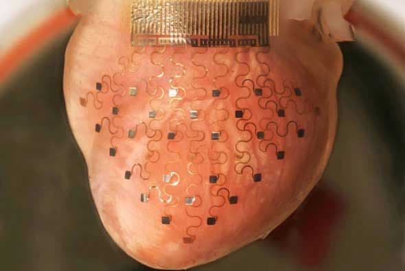 Crean marcapasos en forma de membrana