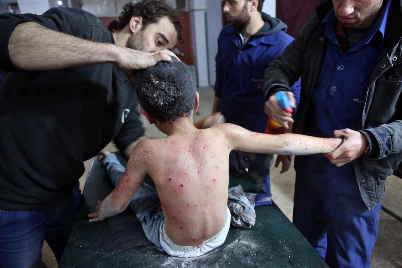 Uno de los centenares de infantes afectados. Desde el comienzo de la guerra en 2012, más de seis millones de sirios huyeron al extranjero generando una de las peores crisis de refugiados de los últimos tiempos.