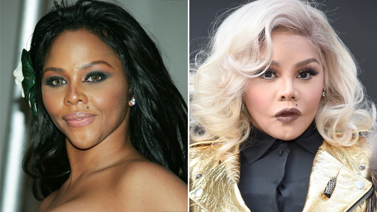 Sólo nos preguntamos, ¿por qué Lil' Kim? No sólo cirugías sino ¿tratamiento blanqueador?