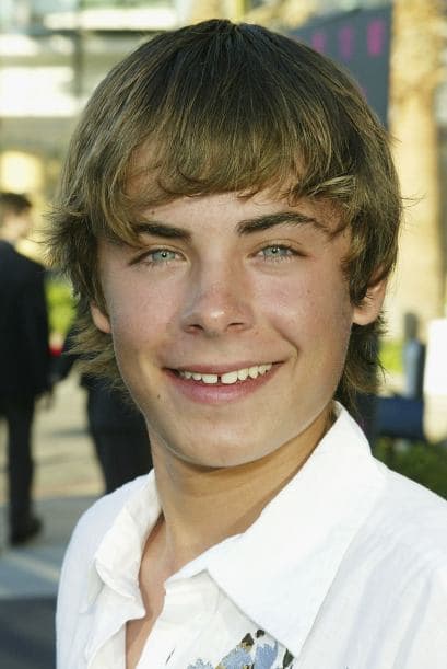 Si de hablar de transformaciones bucales se trata, Zac Efron definitivamente se encuentra en el 'top ten'.