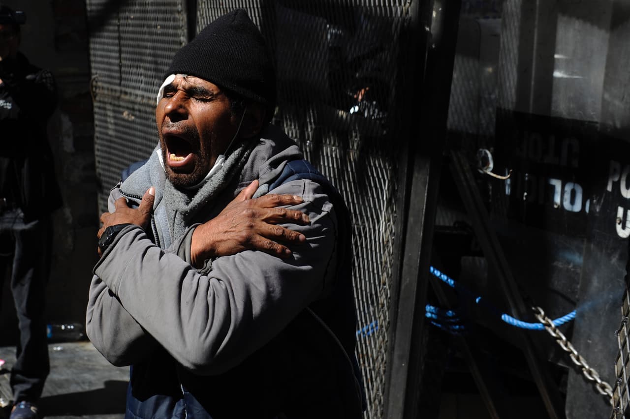 Un manifestante afectado por la represión de la policía antidisturbios.