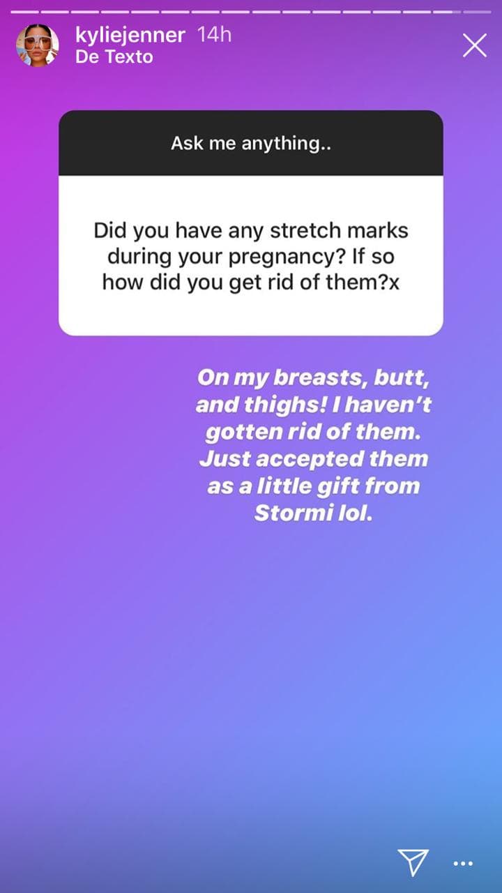 Reveló que tiene estrías en sus "senos, glúteos y muslos", pero no ha tratado de deshacerse de ellas.