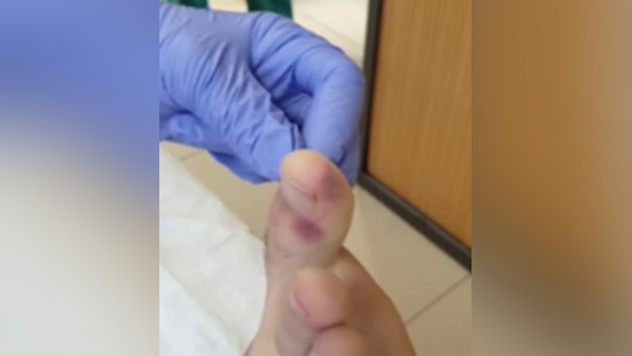 Estas condiciones se pueden presentar en pacientes que han resultado positivos con covid-19, pero no son únicas de la enfermedad.