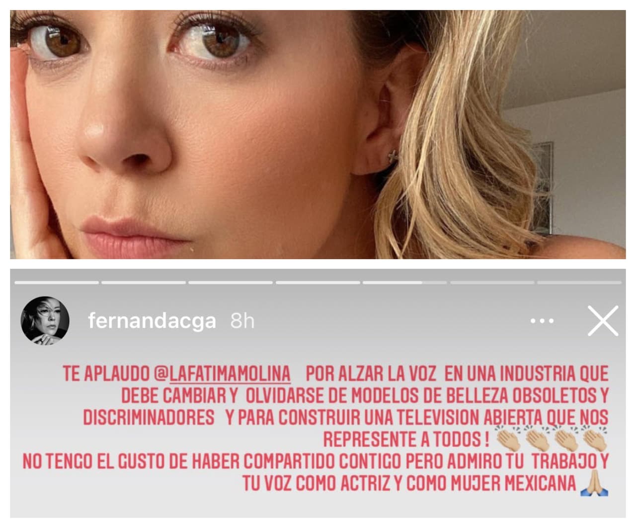 Fernanda Castillo 
<b><a href="https://www.univision.com/famosos/fernanda-castillo-mejora-salud-famosos-porras-fotos" target="_blank">hizo una pausa en su recuperación</a></b> para dedicarle unas palabras a Fátima Molina. Mencionó que, aunque no ha tenido el "gusto" de trabajar junto a ella, la aplaude "por alzar la voz en una industria que debe cambiar".