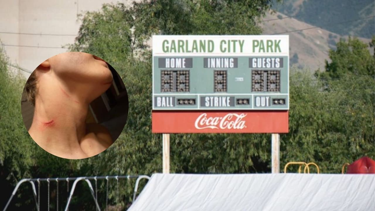 Enfermero de 34 años es acusado de abuso infantil por agredir a menor en juego de kickball