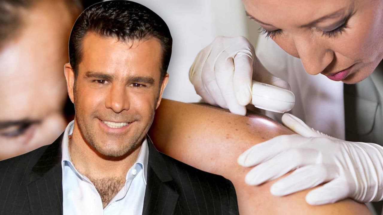 Eduardo Capetillo revela que le detectaron cáncer de piel y ahora aconseja a otros a cuidarse del sol