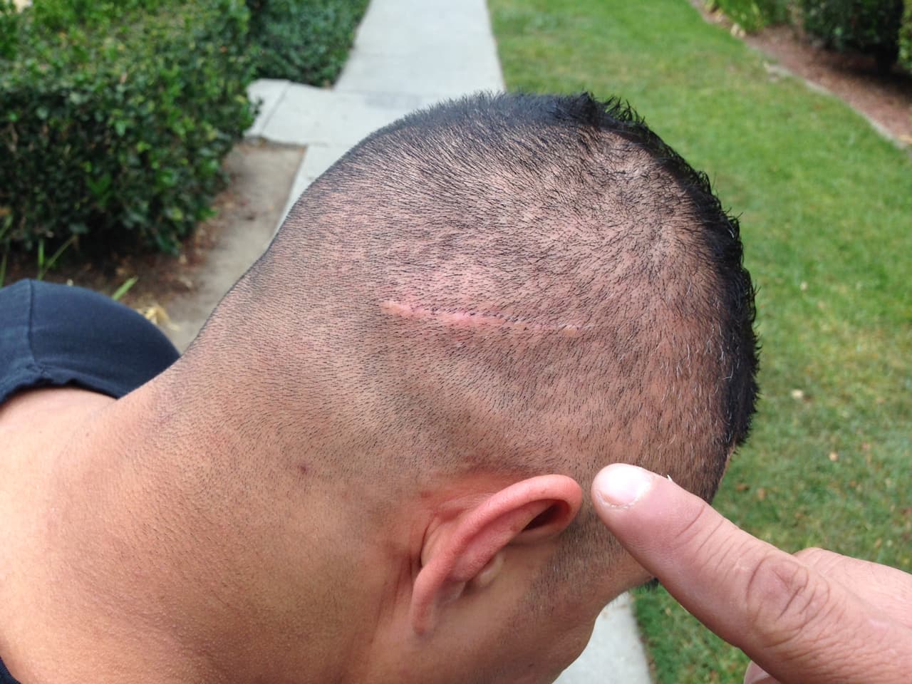 'Potro Romano' sufrió serias lesiones por su actividad en el ring, pero su vida de luchador suele pasar desapercibida para su entorno. Como si fuera un superhéroe de cómic prefiere no revelar su 
<i>alter ego</i>.