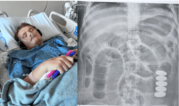 Mujer alerta a padres de familia sobre un juguete que envió a su hijo al hospital   