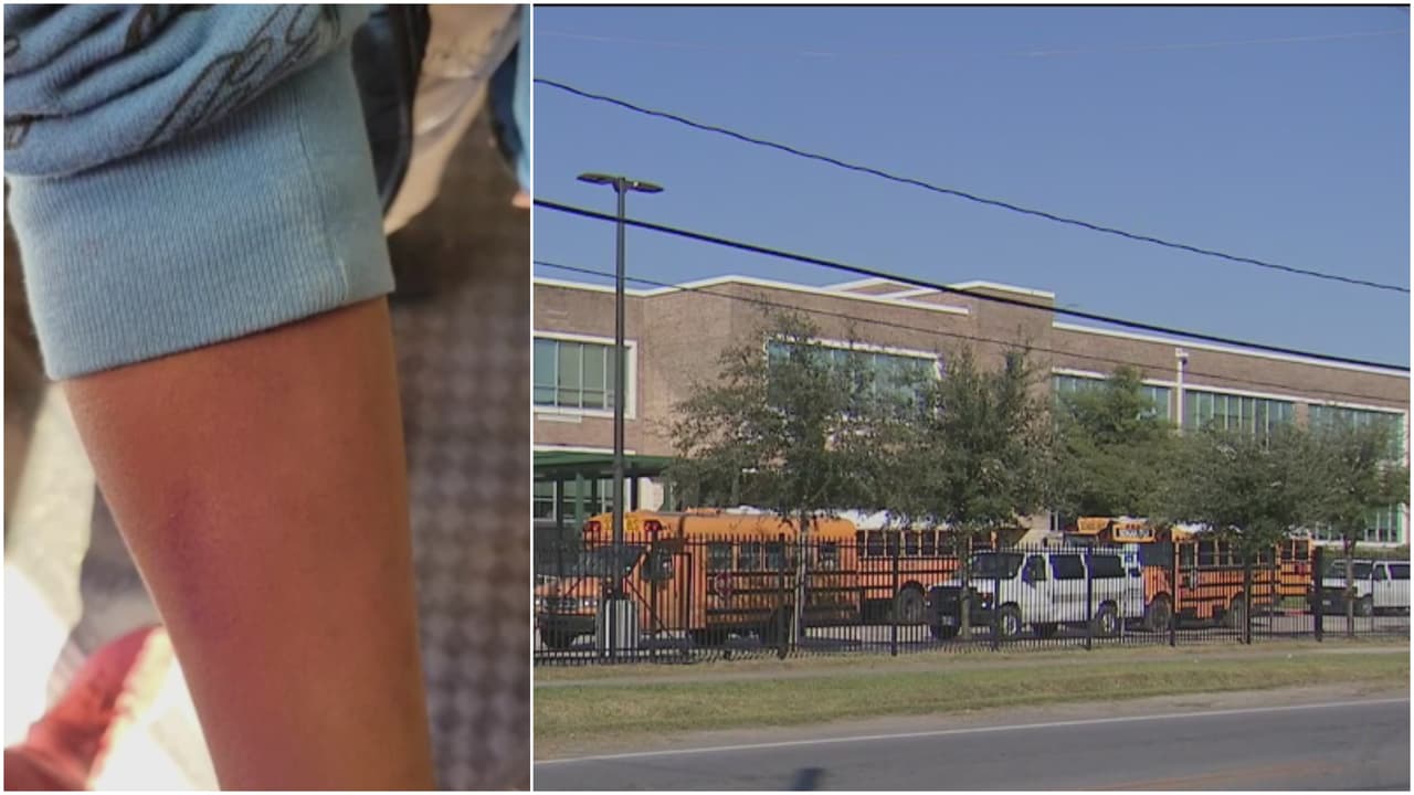 Al parecer, la docente de una escuela de HISD agarró fuertemente a 
<b><a href="https://www.univision.com/local/houston-kxln/hisd-burbank-escuela-houston-areonna-barlow">Areonna Barlow, </a></b>de 12 años, provocándole moretones en los brazos.
