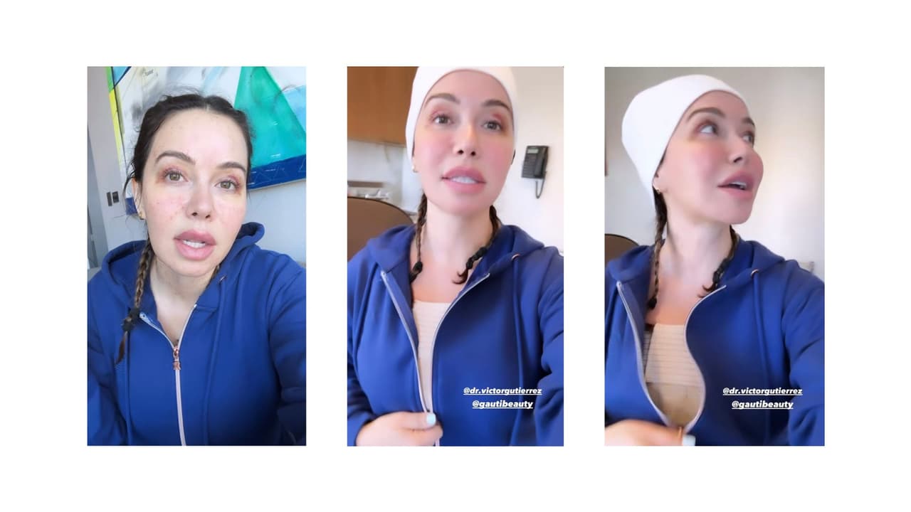 Chquis se sometió a una mamoplastia reductiva y se realizó el Morpheus 8.