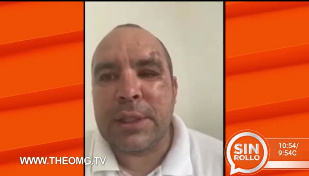 A finales del mes pasado, el fotógrafo Ernesto Zepeda, quien denunció ante las autoridades mexicanas a Livia Brito por supuestamente haberlo golpeado y robado sus pertenencias, dio a conocer que la actriz lo había acusado de arruinar su trayectoria: "Tú destruiste mi carrera", alegó que le dijo.