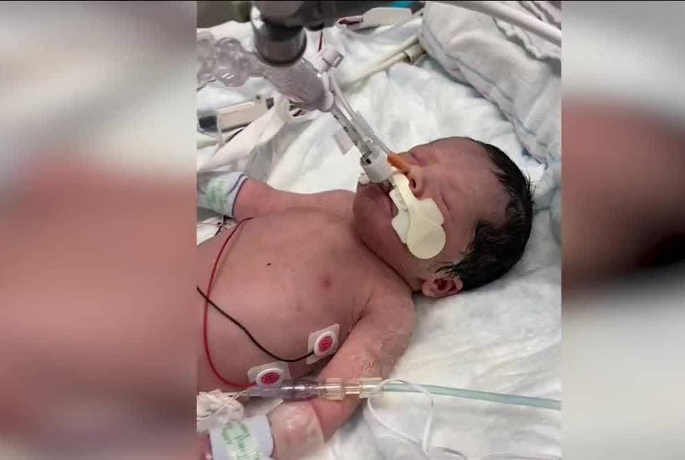 Milagrosamente, la pequeña 
<b>Adalyn Rose sobrevivió, pero ahora está luchando por su vida en una sala de terapia intensiva.</b>