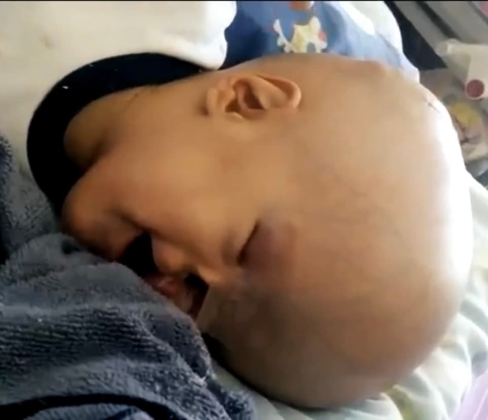 “No ha sido fácil porque
<b> me tengo que aguantar mucho cuando lo veo llorar en el hospital</b>; esos son los momentos más duros, porque no quiero verlo sufrir”, precisa la abnegada mujer. 
<br>