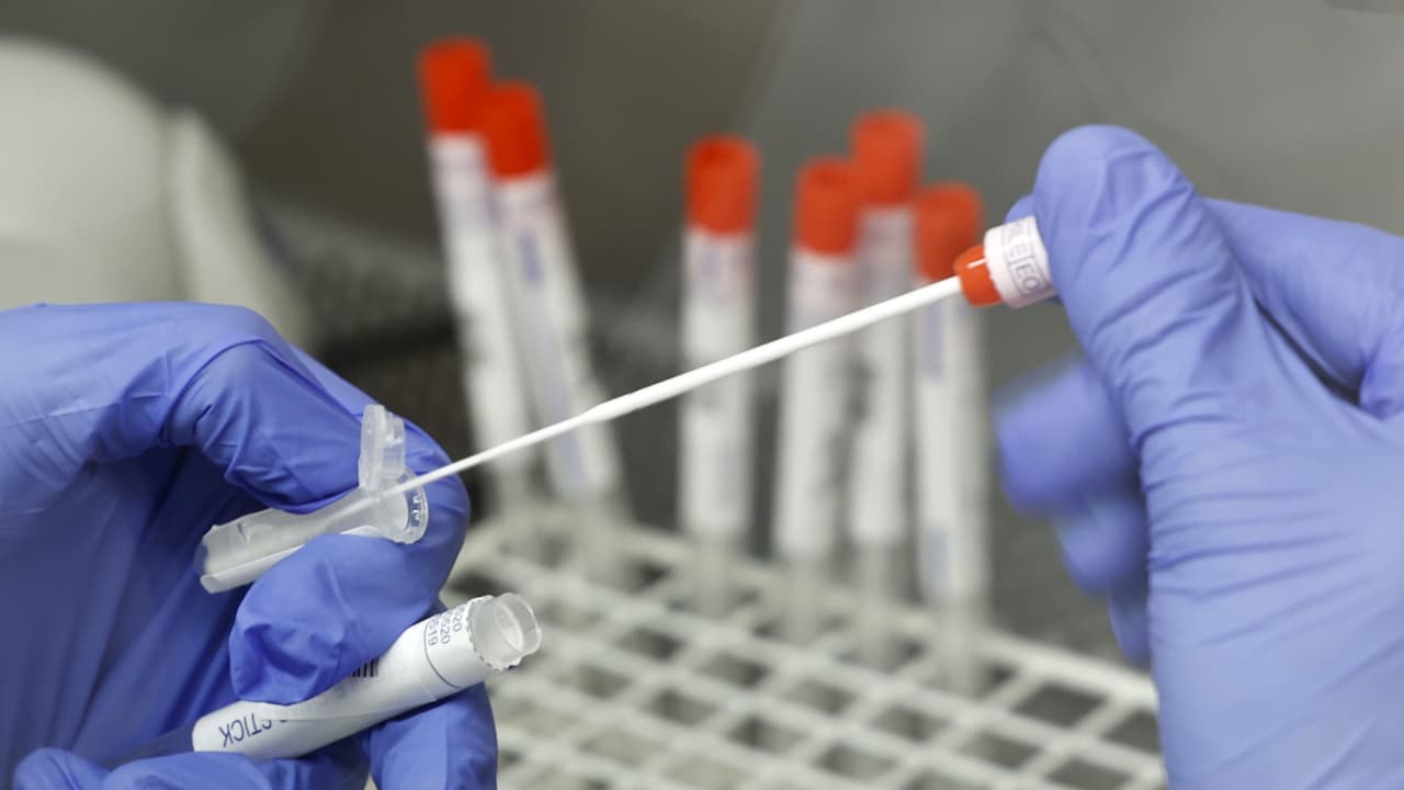 El doctor Alfredo Mena Lora asegura que, aunque en el estado se reportan más casos de gamma, la variante delta es más transmisible. “Debemos hacer todo lo posible para protegernos y la mejor herramienta para eso es la vacuna”, aclaró el especialista, quien explicó que los antídotos ofrecen una alta protección contra todas las variaciones del virus.