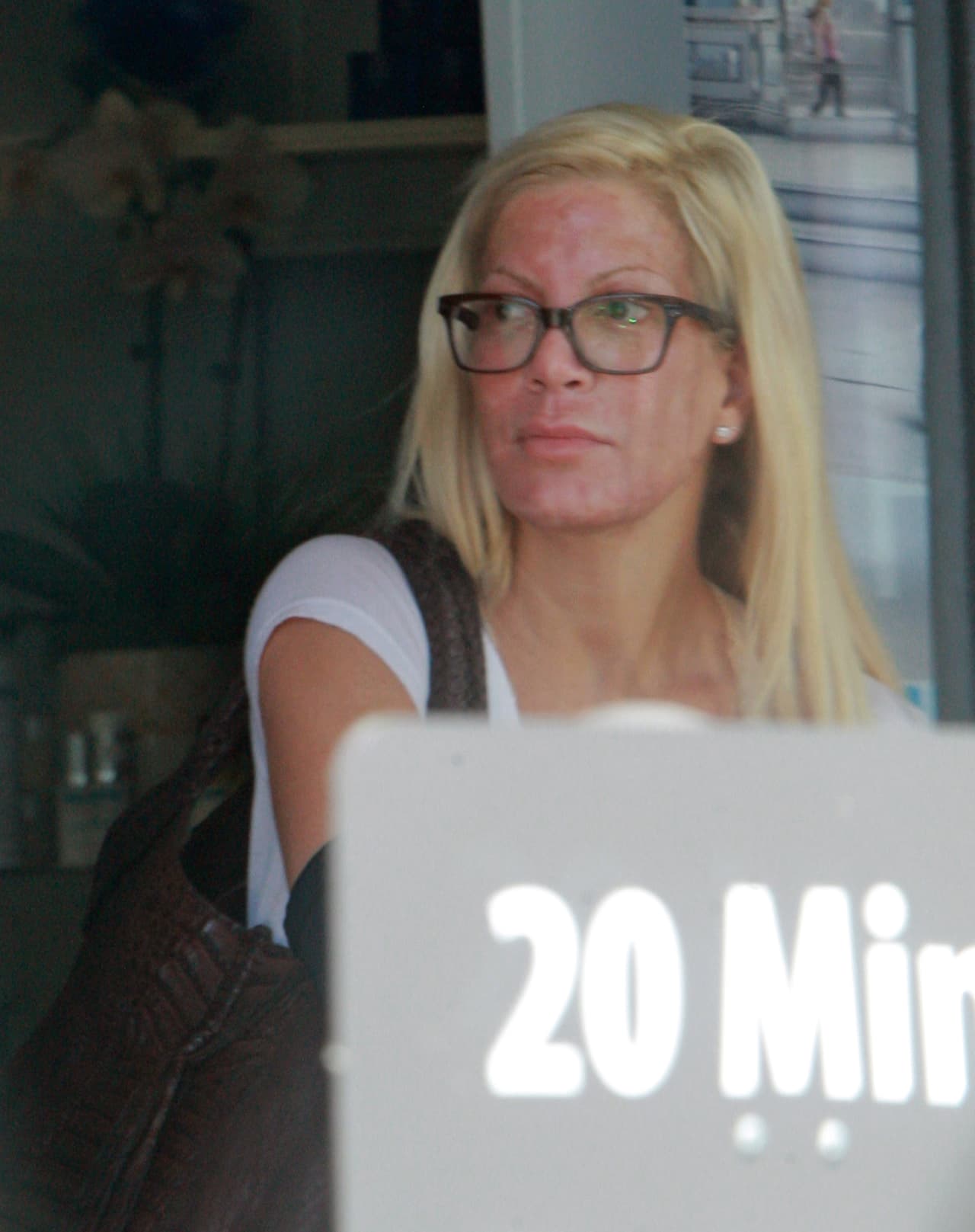 La actriz tenía el rostro hecho pedazos.