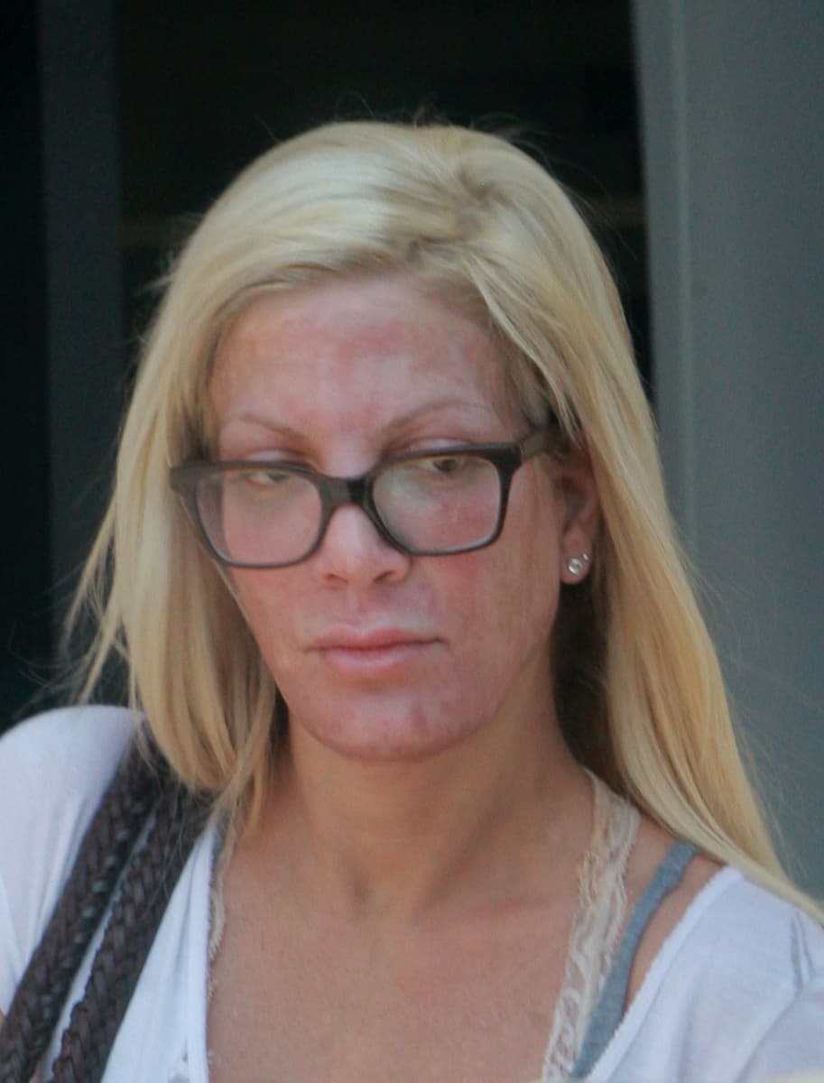 Una dermoabrasión, exfoliación química y hasta una depilación de cejas.