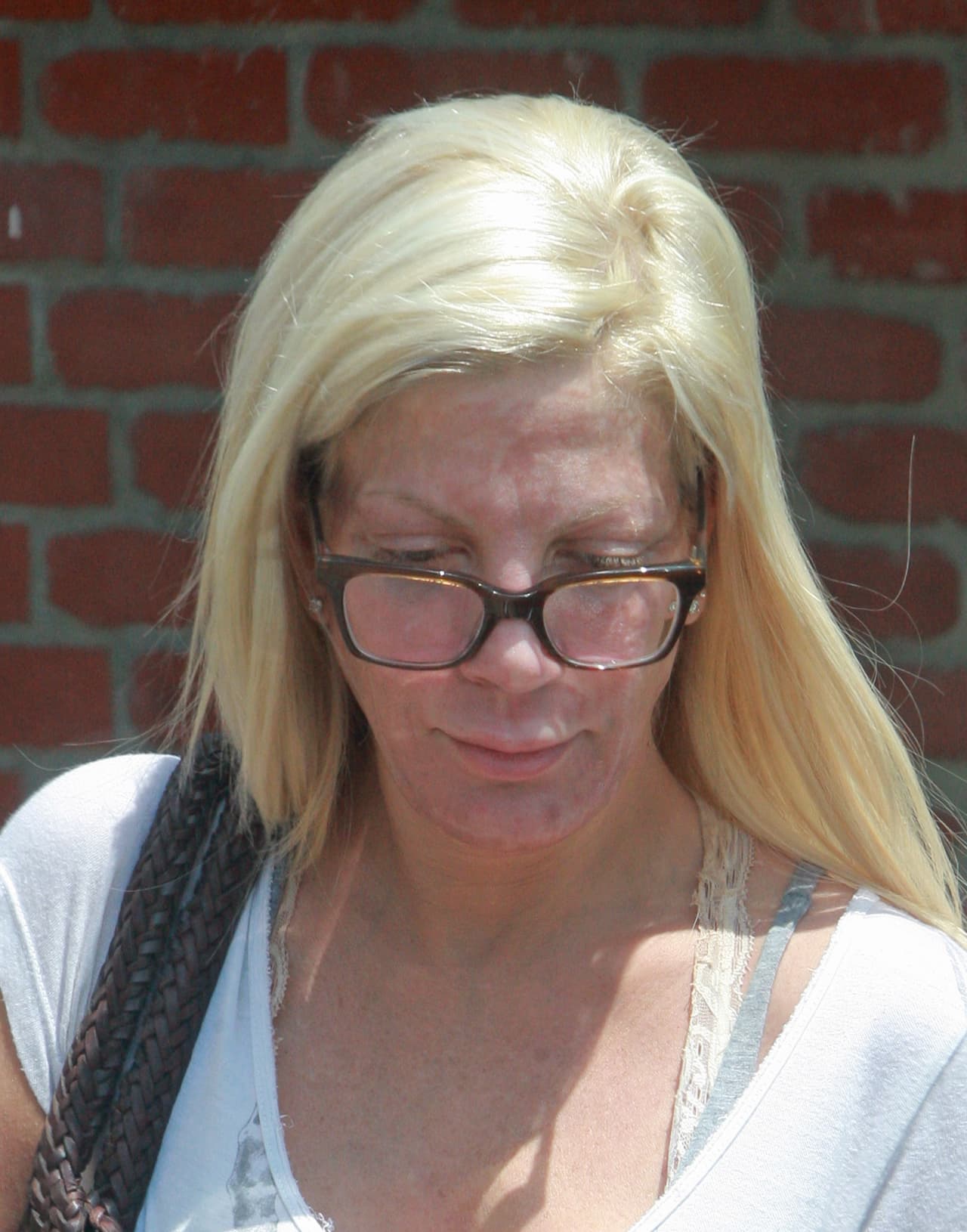 Estos "arreglitos" le costaron aproximadamente 400 dólares.