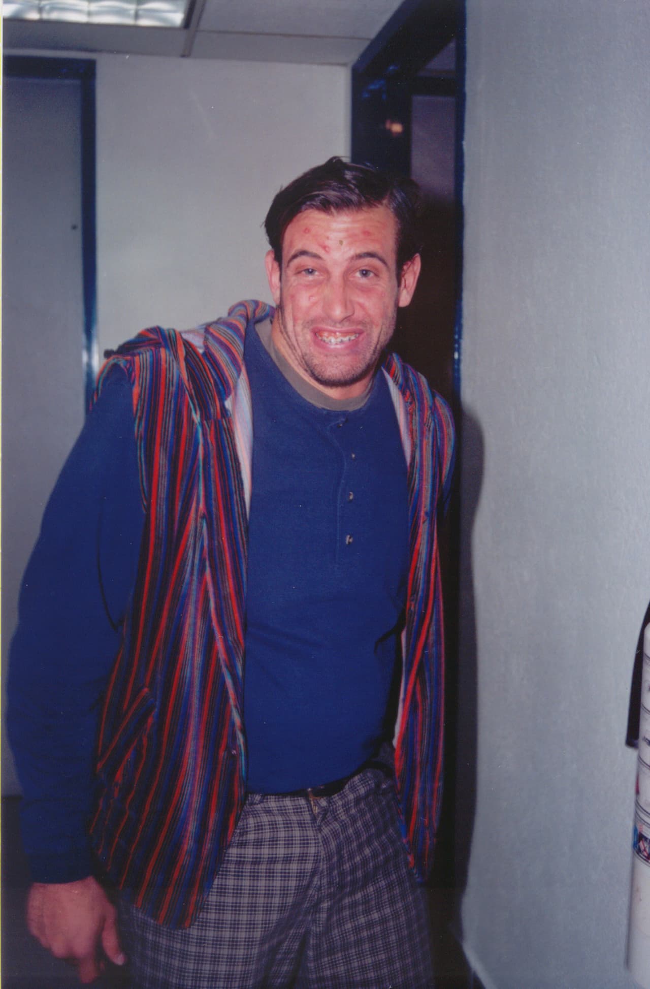 Así que fue toda una sorpresa verlo repleto de acné y con frenos dentales para interpretar a Ulises Barrientos 'El Feo'.