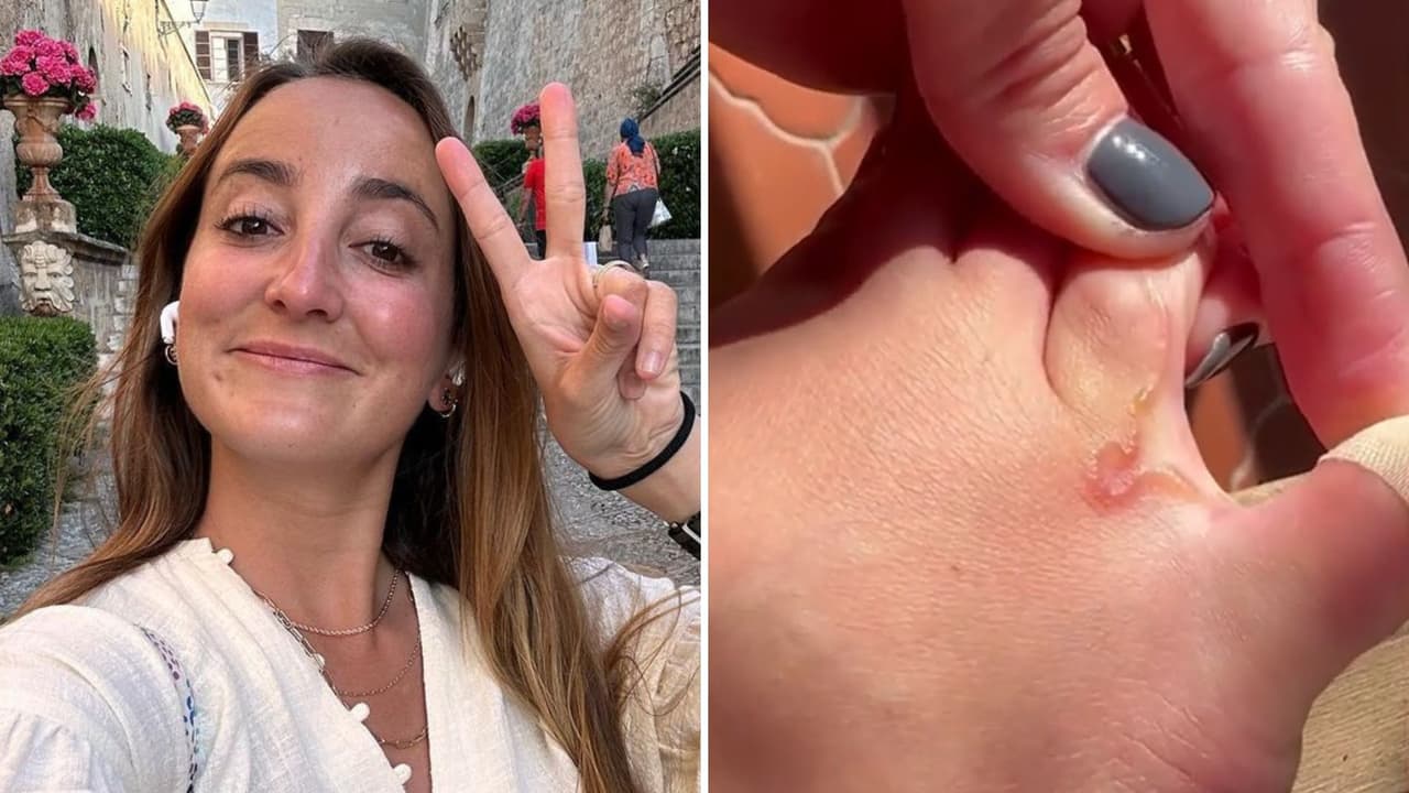 Estrella de TV revela que tiene un gusano vivo dentro del pie: “Noto cómo se mueve”