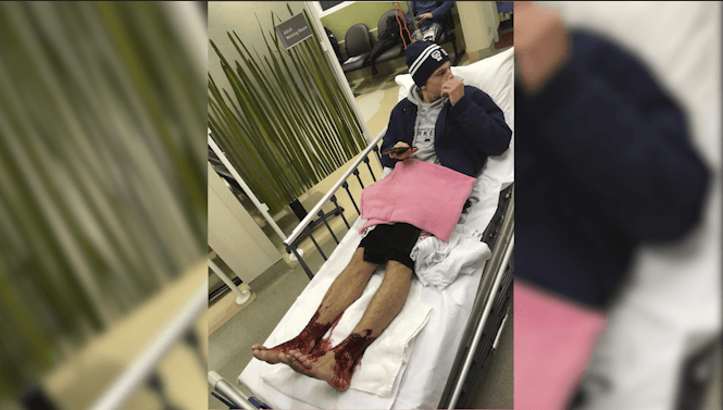 Se mete en una playa de Australia y sale con los pies llenos de sangre por pequeñas mordeduras