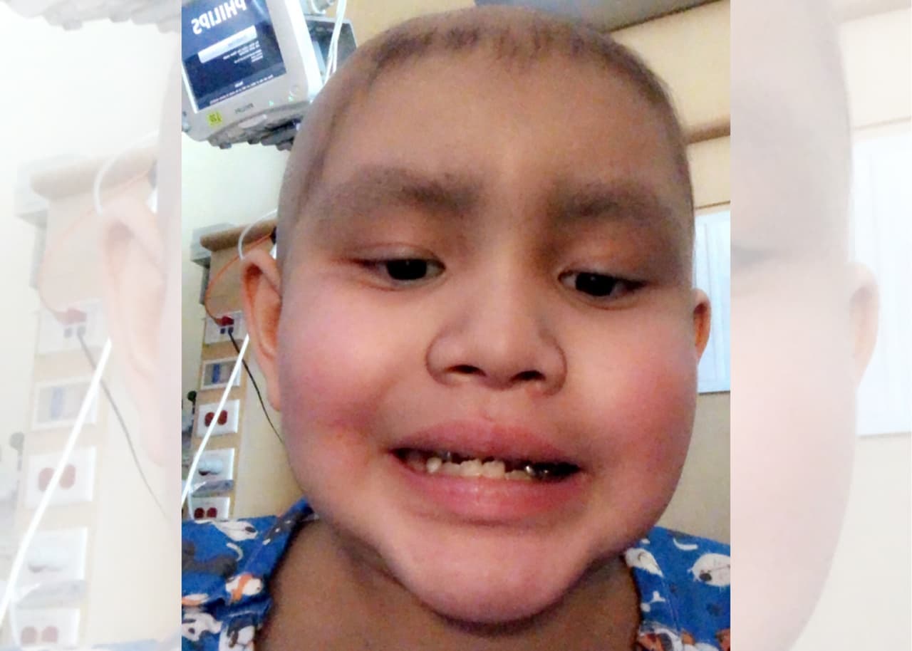 Un niño de Coalinga necesita donante de médula luego que su cuerpo rechazara el primer trasplante