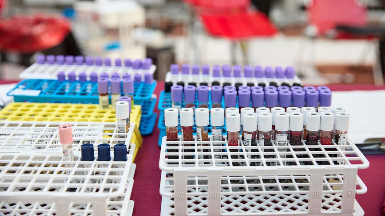 Hay escasez de sangre en Estados Unidos: Cruz Roja