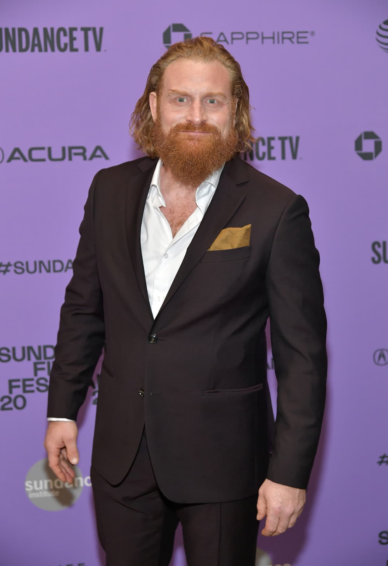 El actor 
<b>Kristofer Hivju</b>, quien brincó a la fama por su papel de Tormund Giantsbane en la multipremiada serie 
<b><a href="https://www.univision.com/noticias/trending/cerca-de-un-millon-de-personas-piden-a-hbo-que-rehaga-la-temporada-final-de-game-of-thrones-ojo-contiene-spoilers" target="_blank">'Game of thrones'</a></b>, informó que también tuvo el virus. Luego de varios días en tratamiento, se repuso.
<br>