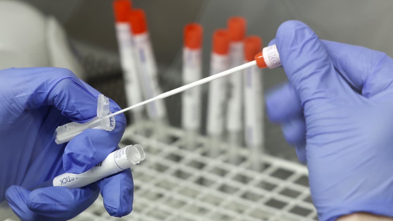 “Puede causar una infección más larga”: lo que se sabe de nueva cepa del coronavirus detectada por científicos en Texas