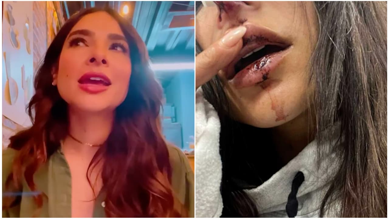 Alejandra Espinoza cree que su accidente fue "karma" por lo que le hizo a Matteo y su esposo