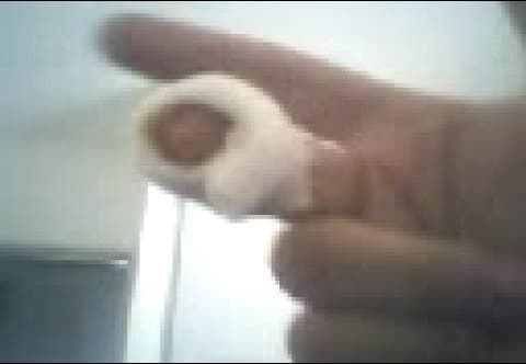 Montserrat cometió la imprudencia de meter el dedo medio de su mano derecha en el hocico del animal: "jalé el dedo y la leona se lo comió". Fue trasladada al hospital, la operaron para reconstruirle su dedo y asistió a terapias en cámara hiperbárica para evitar infecciones.